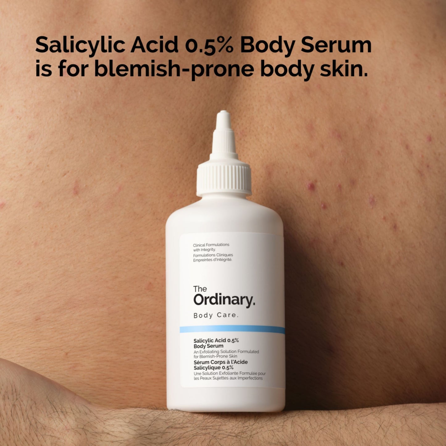 The Ordinary Salicylic Acid 0.5% Body Serum -240ml
