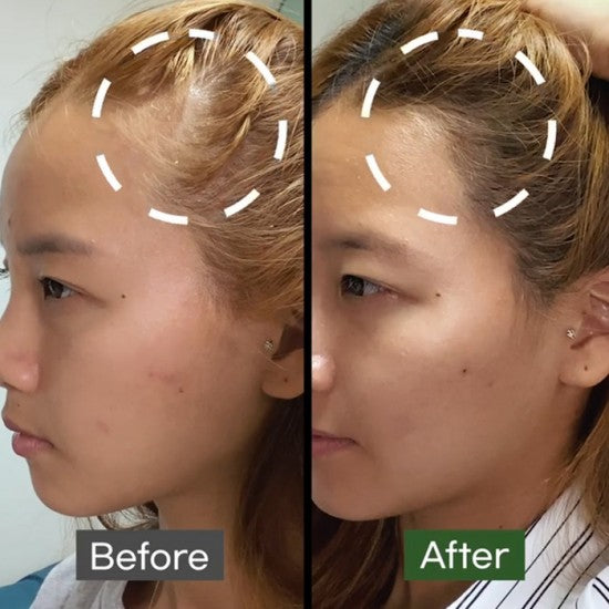 Some By MI Cica Peptide Anti Hair Loss Derma Scalp Tonic -150ml