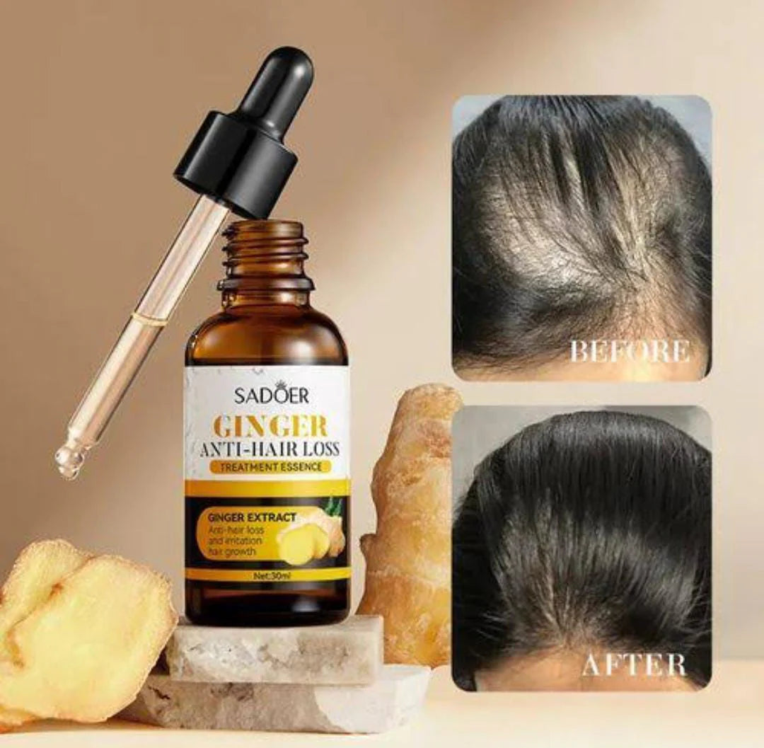 SADOER Ginger Anti-Hair Loss Oil Essence -30ml