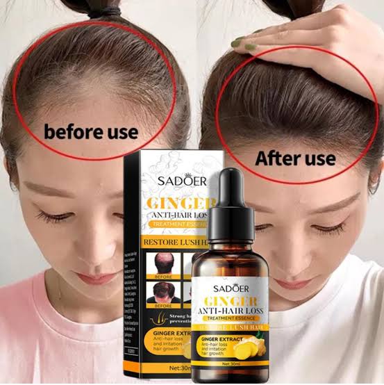 SADOER Ginger Anti-Hair Loss Oil Essence -30ml