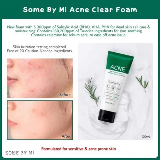 Some By MI- AHA BHA PHA 30 Days Miracle Acne Clear Foam -100ml