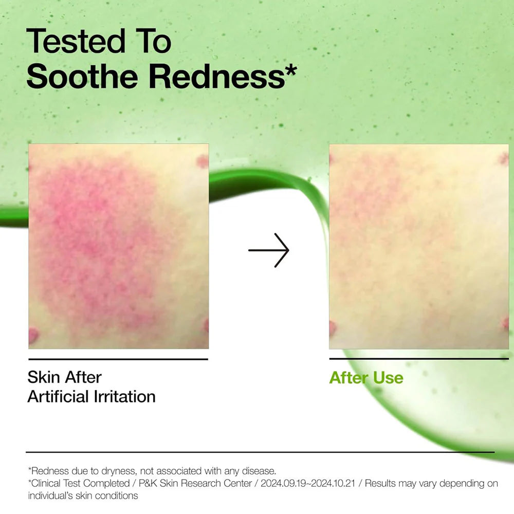 Anua Azelaic Acid 10+ Hyaluron Redness Soothing Serum -30ml
