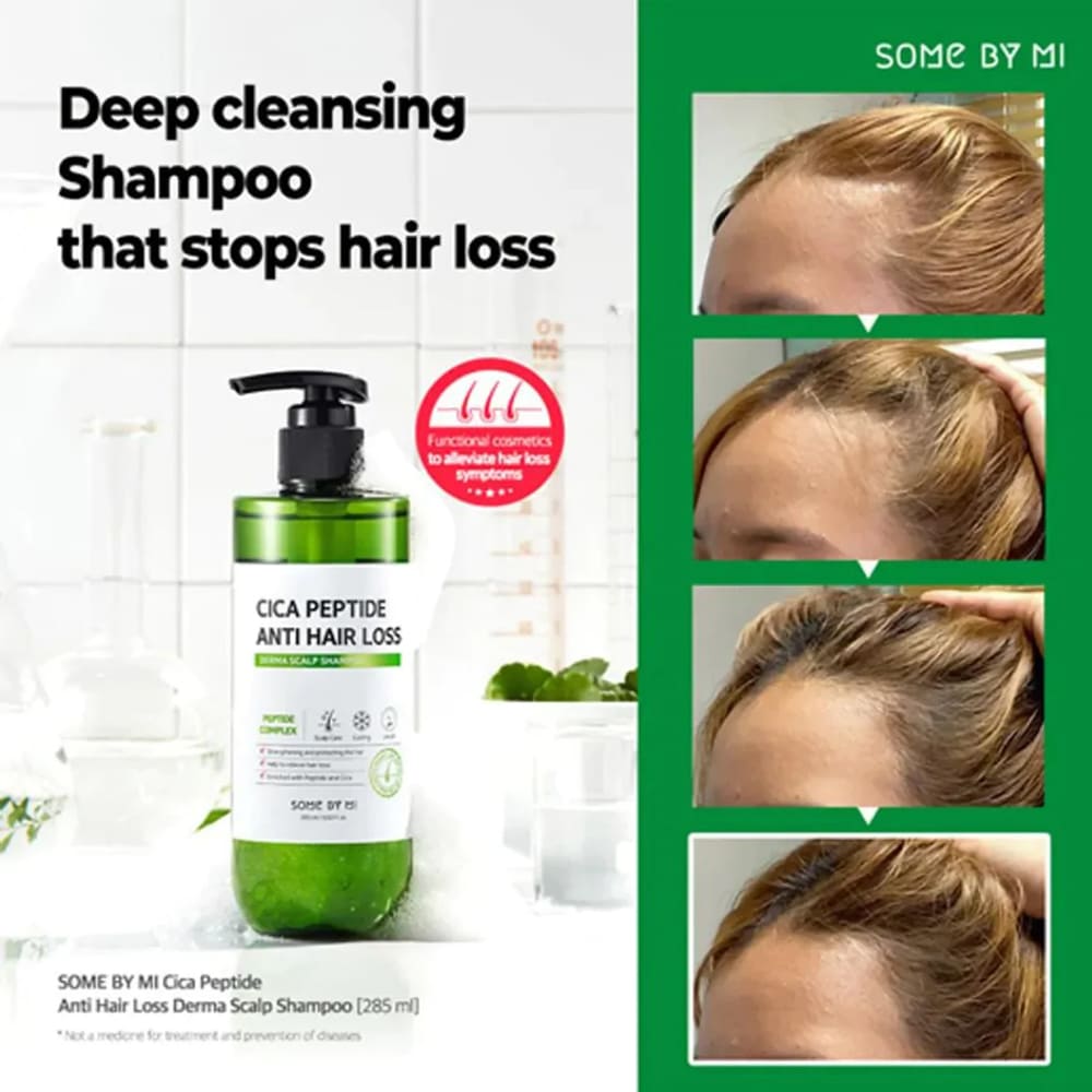Some By MI Cica Peptide Anti Hair Loss Derma Scalp Tonic -150ml