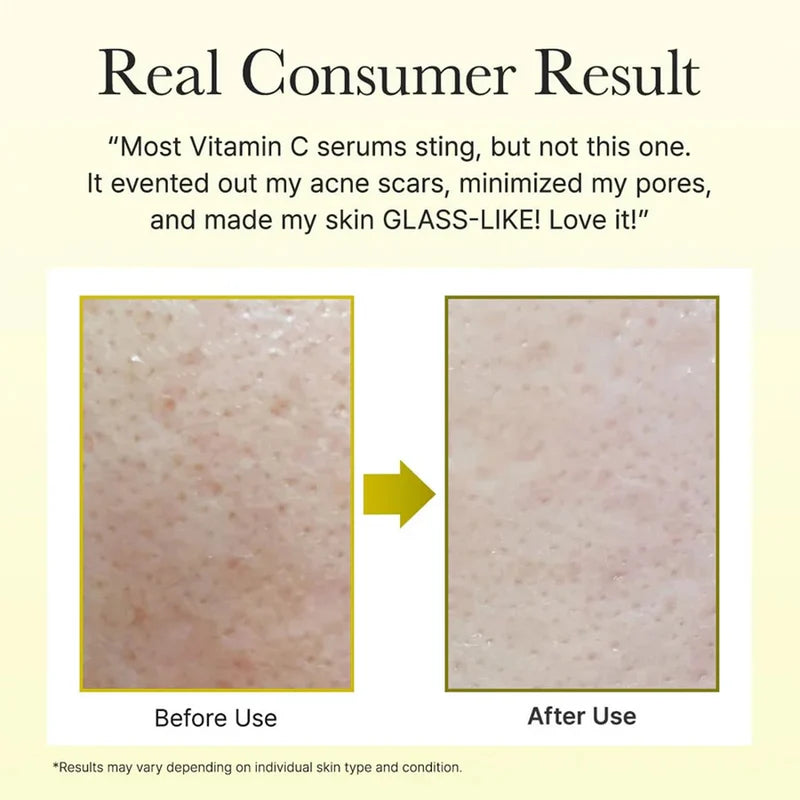 Arencia Vitamin C Booster Shot -30ml