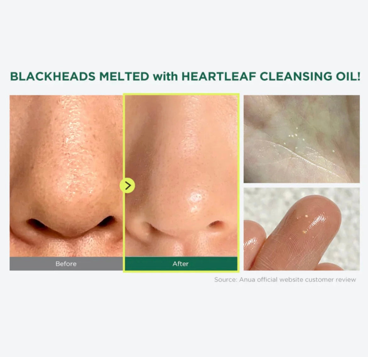 Anua Pore Control Cleansing Oil 20ml – Deep Cleansing, Pore Care & Oil Control For Clear Skin