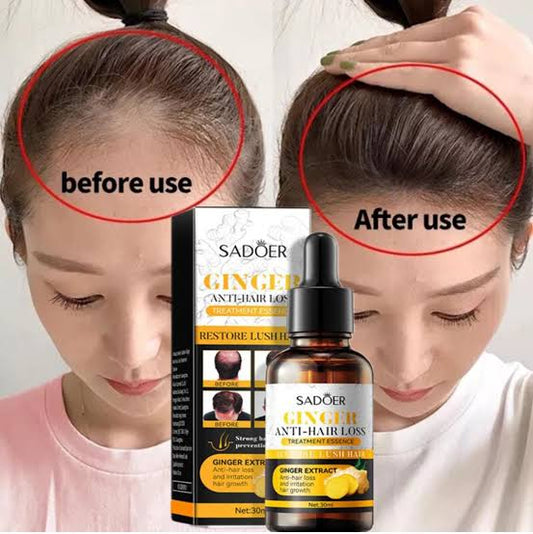 SADOER Ginger Anti-Hair Loss Oil Essence -30ml