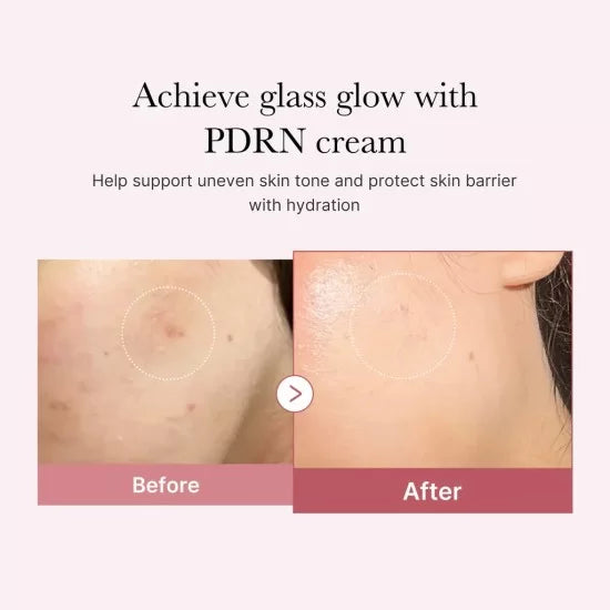 Medicube PDRN Pink Hyaluronic Moisturizing Cream 50ml | Deep Hydration & Repair
