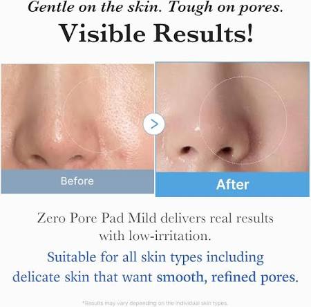 Medicube Zero Pore Pad | Pore Refining