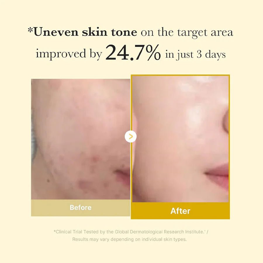 Medicube Kojic Acid Turmeric Night Wrapping Mask –75ml